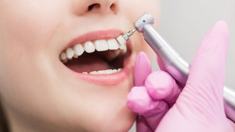 Affordable Austin TX Dentist: Your Perfect Place for Oral Surgeries