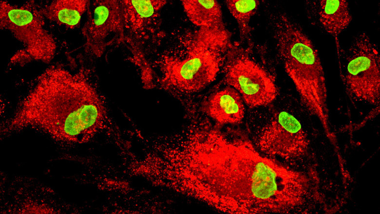 Global Mesenchymal Stem Cells Market Analysis