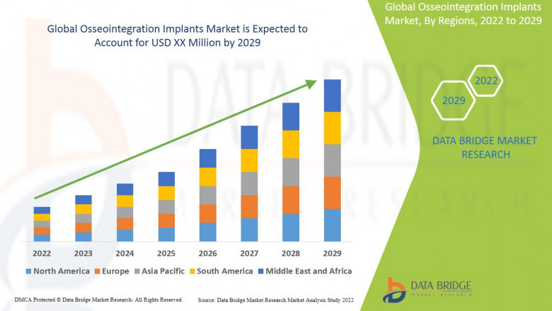 Osseointegration Implants Market is set to Witness Huge Demand at a CAGR of 8.2% during the Forecast Period 2029