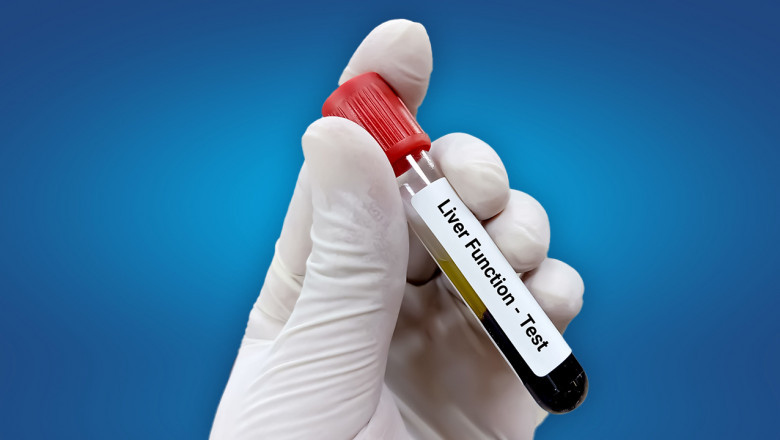 Significance of Liver Function Test