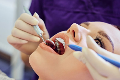 Advantages of Implant-Supported Dentures - Cheap Dental implant In London