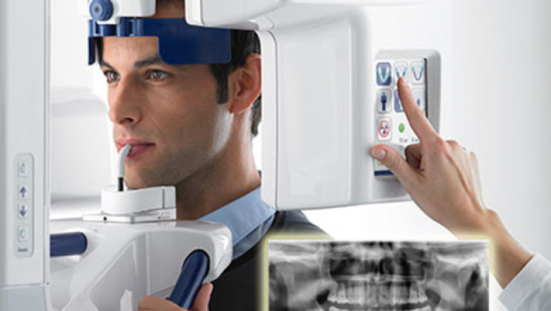 Digital Radiography Market Insights, Growth Analysis, Forecast 2020-2027