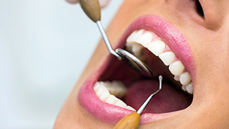 Invisalign Charlotte Nc | Blakeneysmiledentistry.com