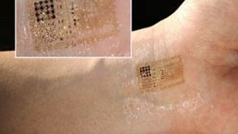 Epidermal Electronic Devices Market 2022 Global Trends, Size and Forecast Report to 2028