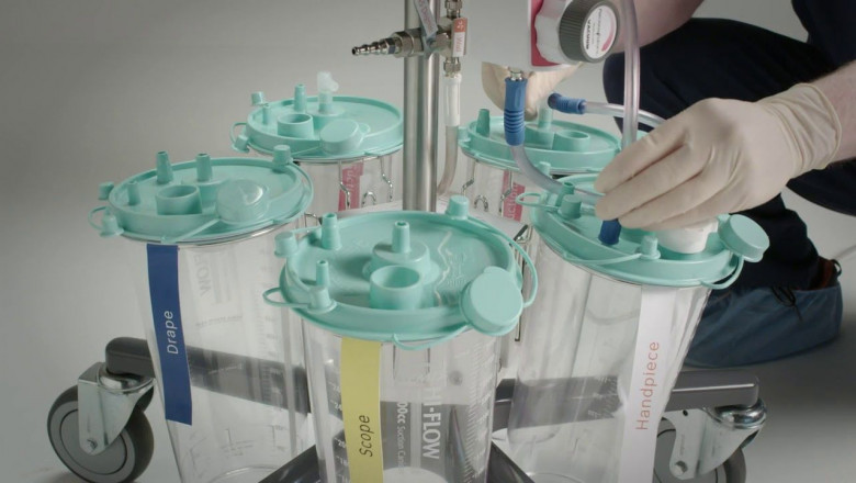 A study of the global Fluid Management System Market: trends, market size, growth, opportunity, as well as forecasts for 2022-2028