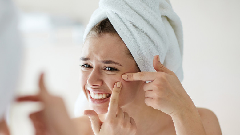 Acne Medication Depends on Age, Type, and Severity