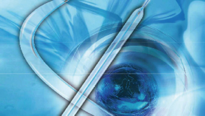 PTA Balloon Catheter Market Size, Share, Growth, Opportunities and Global Forecast to 2028