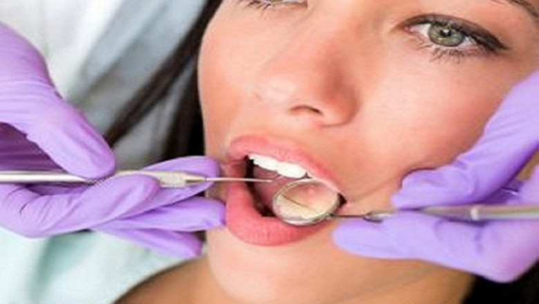 What Are the Benefits of Invisalign Over Braces?