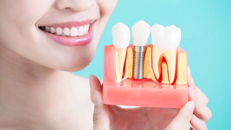 What Are The Symptoms Of Periodontitis Diseases?