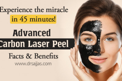 How is Carbon peel treatment works?