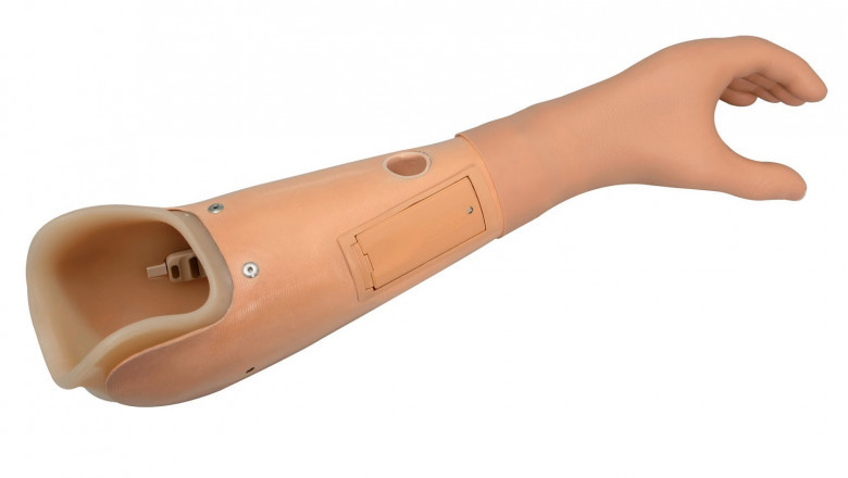 Upper Limb Prosthetics Devices Are Also Developing Solutions For Reducing Trauma Among Amputees