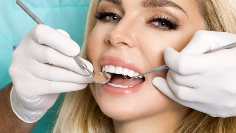 What Are the Differences Between Dental Veneers and Laminates?