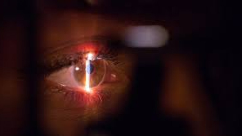 Corneal Edema Treatment Market Size, Share, Regional Overview and Global Forecast to 2028