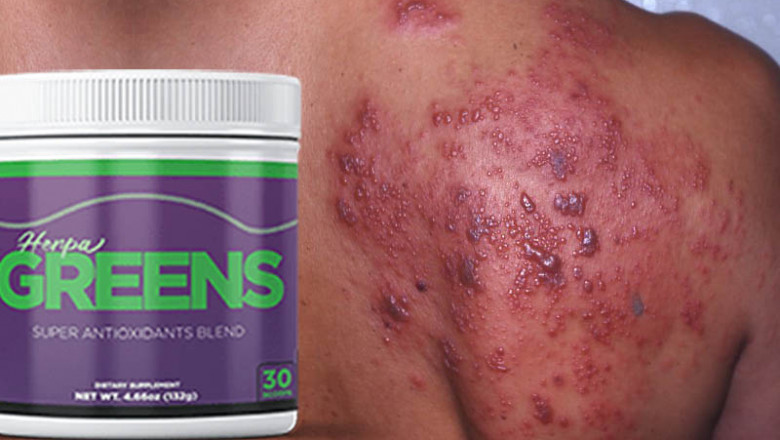 HerpaGreens Supplement Really Work For Herpes Virus?