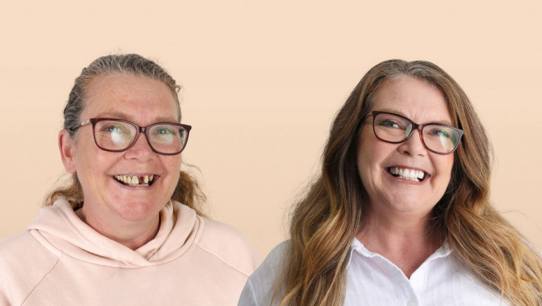 The Link Between Bone Grafts & Dental Implants