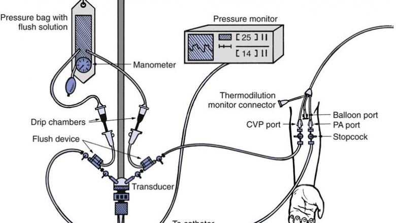 Hemodynamic Monitoring Systems Market Key Factors For Growing Demand, Forecast 2022-2030