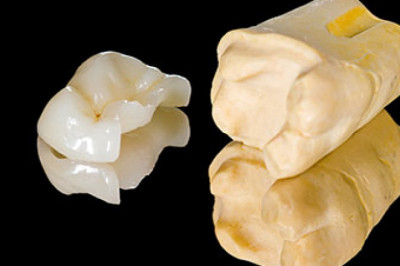 How Do You Select Affordable Dentures?