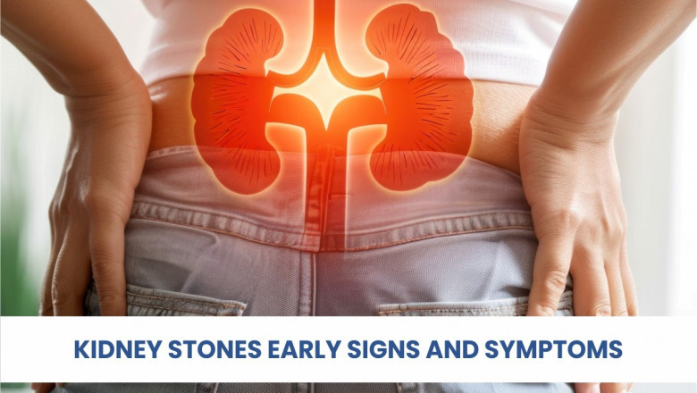 kidney stone early signs to cause pain