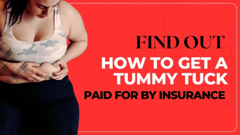 Can Insurance Pay for a Tummy Tuck?