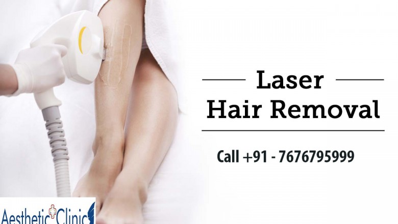 Laser Hair Removal and Laser Tattoo Removal – Aestheticplusclinic.In