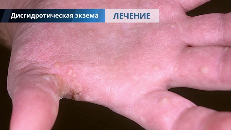 Major Varieties Of Skin Illnesses