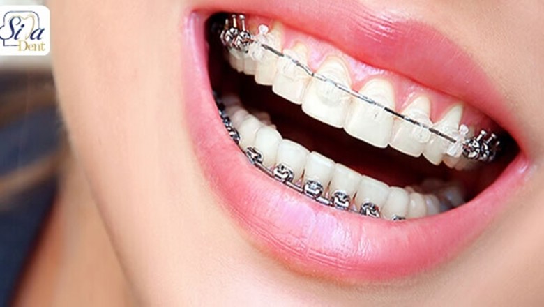 Is Acquiring A good Dentist Tough to Do?