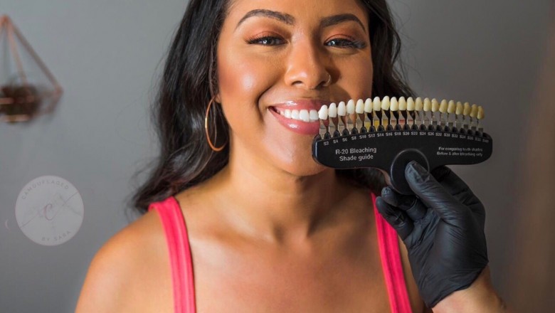 Advantages Of Undergoing Professional Teeth Whitening