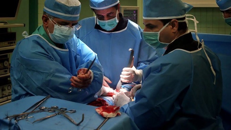 kidney transplant in Delhi