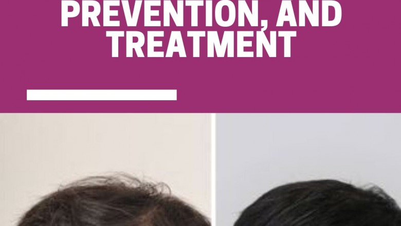 What Is Traction Alopecia? Symptoms, Prevention, And Treatment