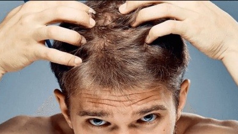 Hair Thinning Lotion Solutions