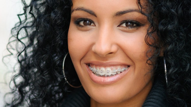 Dentist in Cypress | Cosmetic & General Dentistry | Mirabella Smiles