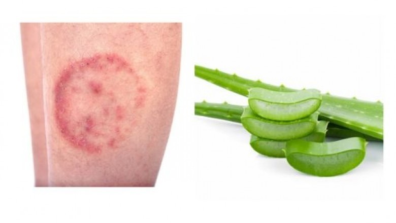 Red spots on skin remedies