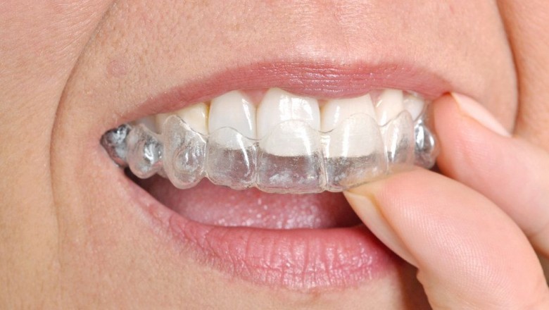 Pros and Cons of Invisalign vs Braces