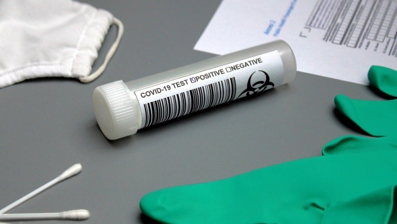 Rapid CLIA ELISA Kits approved for testing of Covid-19 as on 26.05.2020