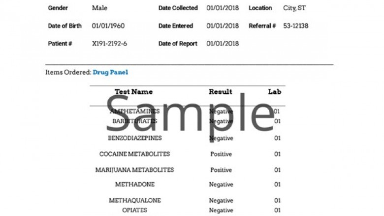 Data About Frequent Drug Testing Approaches