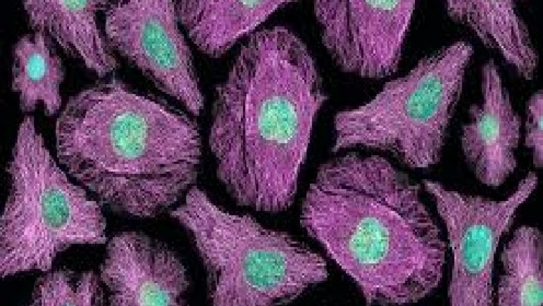 Global Live Cell Imaging Market Trends, Size, Share, Forecast - 2019-2025