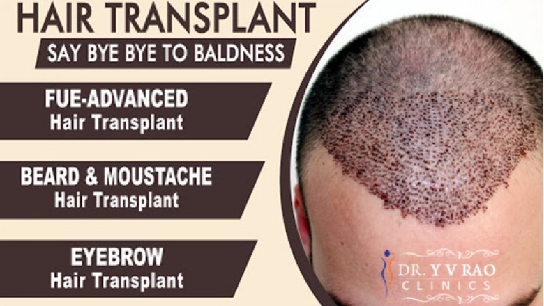 Hair Transplant in Hyderabad | Hair Transplant Cost | Dr.Yv Rao Clinics