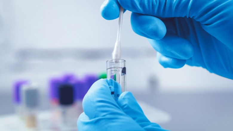 Micronutrient Testing