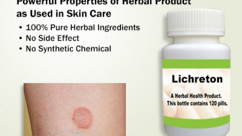 Natural Remedies for Lichen Planus with Self-Care Routine