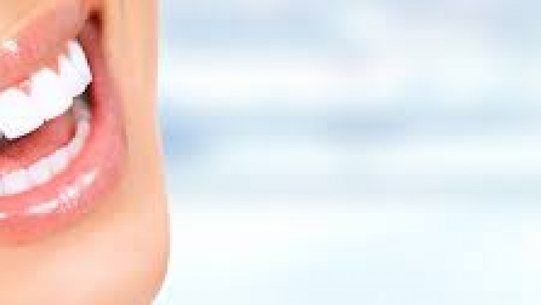 7 Things Parents Need to Know About Invisalign Teen