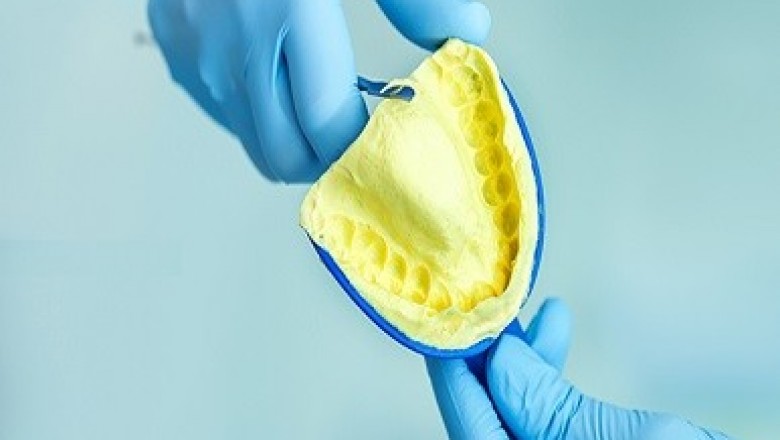 Dental Biomaterial Market–An Overview