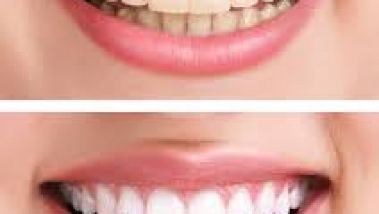 Dental clinic. Longmont