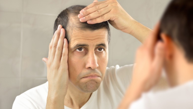 Will donor site hair grow back?