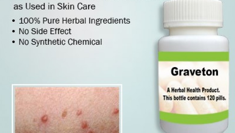 Get Rid of Natural Remedies for Grover’s Disease at Home
