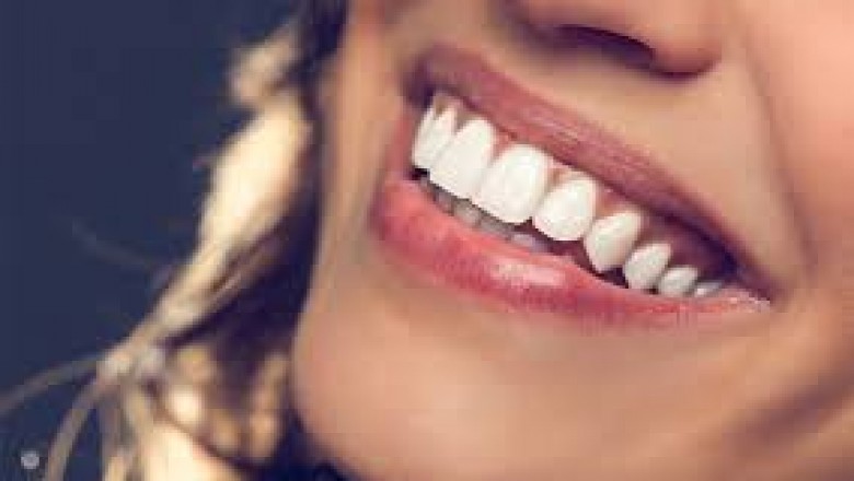 Fluoride Treatment in Houston, TX, Helping Patients Prevent Cavities