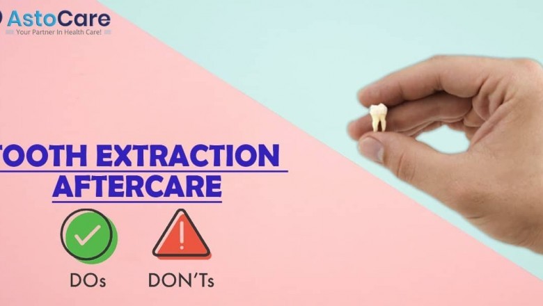 Tooth Extraction Aftercare: Do’s and Don’ts - AstoCare