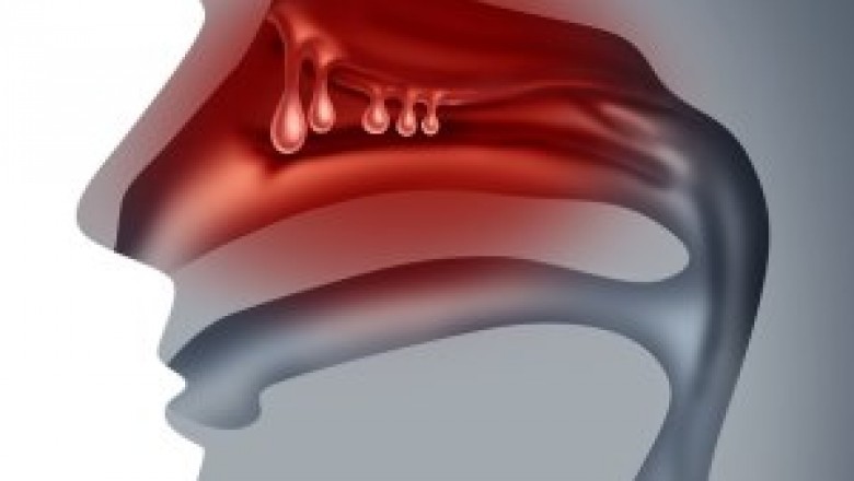 Treatment for nasal polyps involves surgeries and medications to treat nasal polyps that may range from normal to serious to cancerous