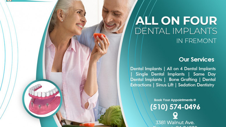 All-on-4 dental implants: 3 distinguishable benefits for an enhanced smile!