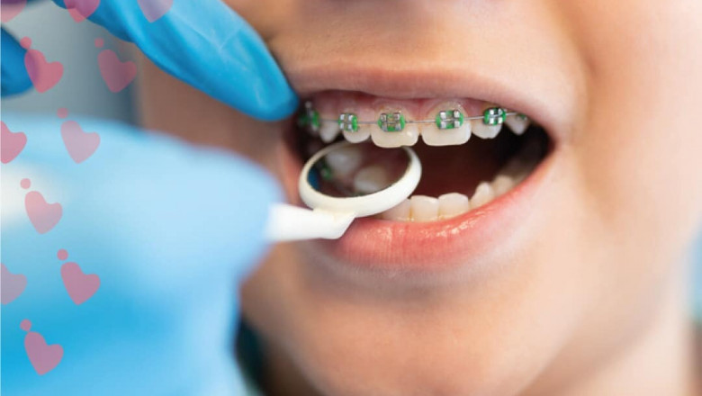 Dr. Yasmin Kottait - Pediatric Dentist in Dubai at myPediaclinic Voted Best Pediatric Clinic in Dubai