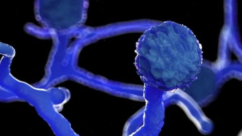 ‘Black fungus’ in Covid-19 patients: what is the disease, treatment